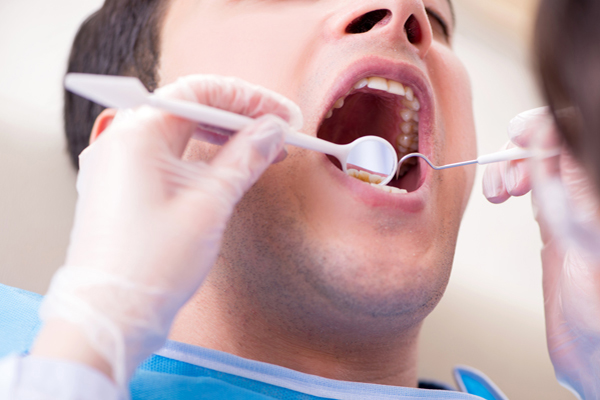 How General Dentistry Practitioners Can Improve Smiles